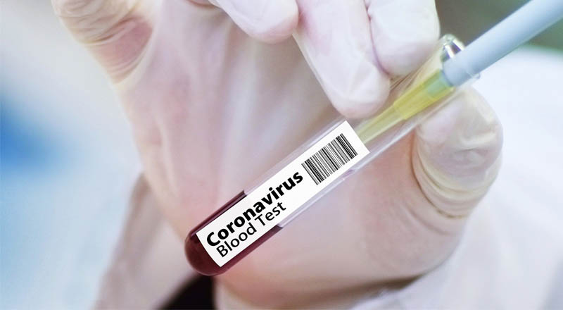 Właściciel PZL Sędziszów S.A.- Spółka UNIMOT S.A przekaże 100 tys. testów na koronawirusa!